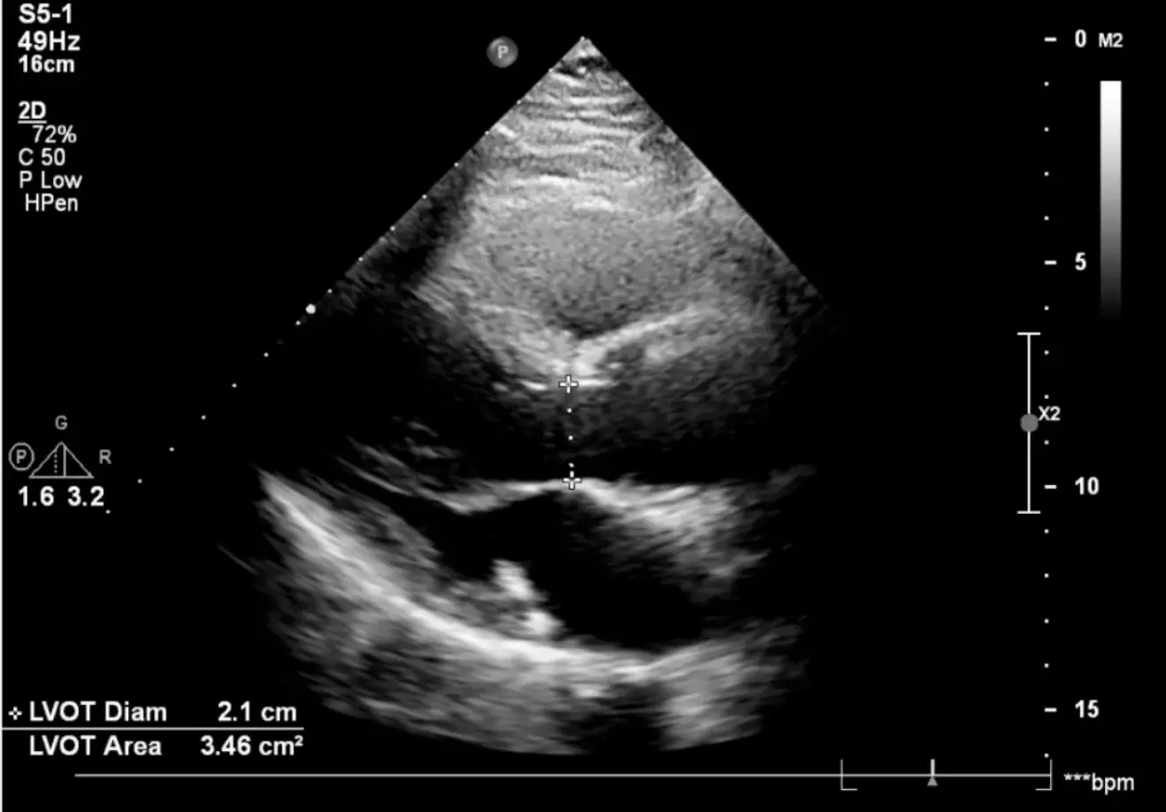 Cálculos Hemodinâmicos | BiocardioTech