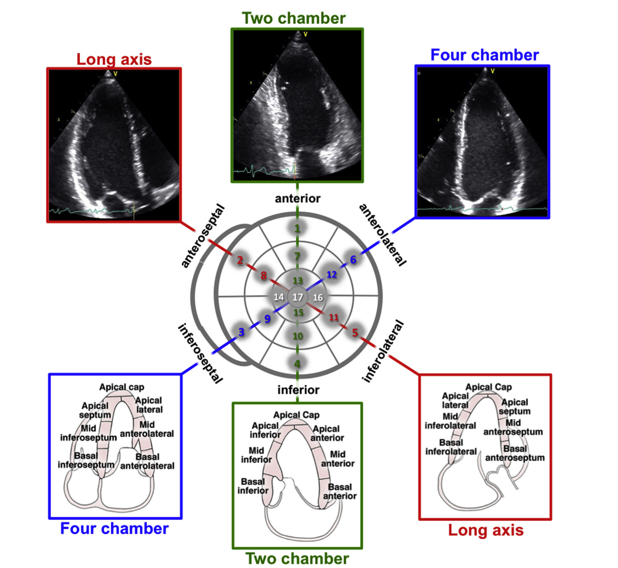 Segmentação do Ventrículo Esquerdo - Modelo de 17 Segmentos